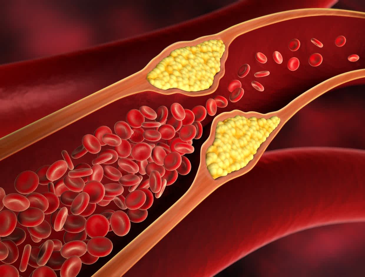 Kolesterol Nedir?